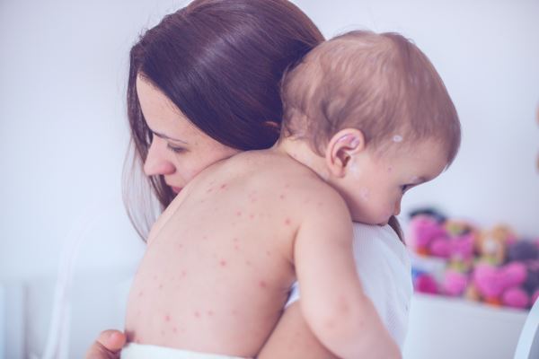 Аллергия у детей до года: симптомы и профилактика